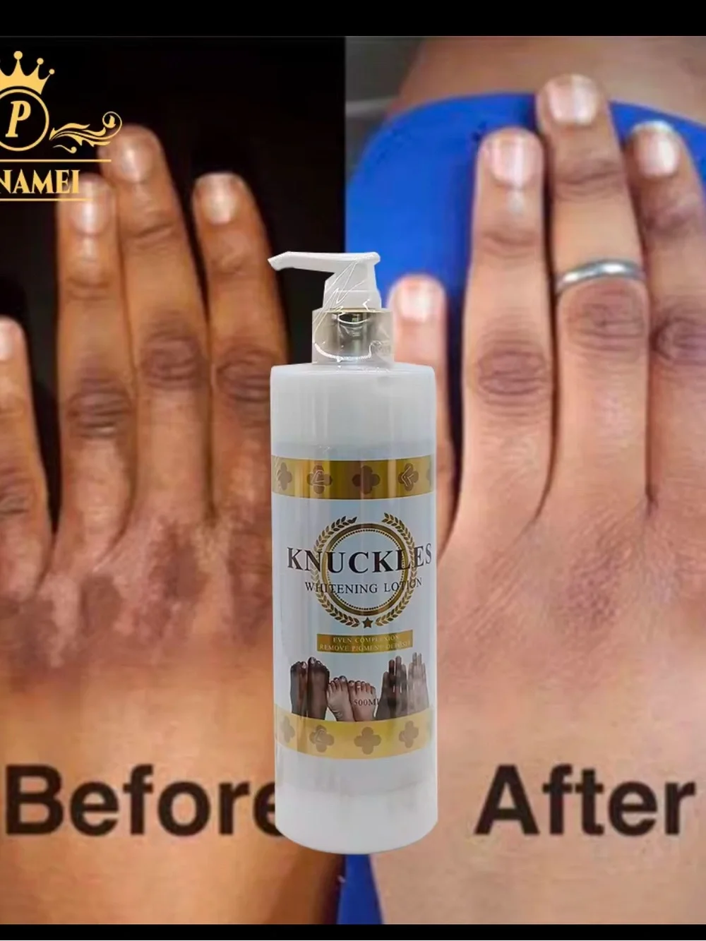 Unbranded whitening lotion